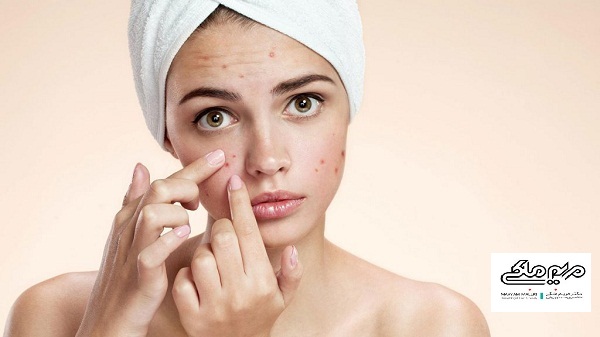 لیزر جای جوش اسکار آکنه یا سوختگی