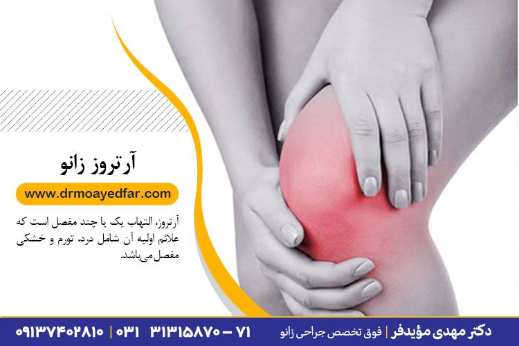 علائم آرتروز زانو
