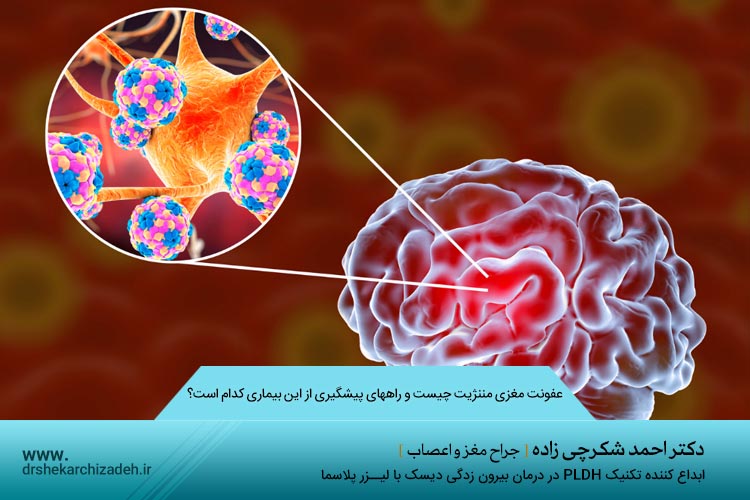 عفونت مغزی مننژیت