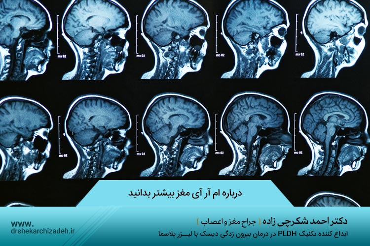 درباره ام آر آی مغز بیشتر بدانید