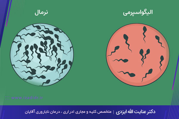 آزوسپرمی در اصفهان