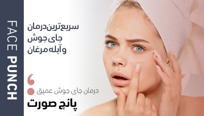 پانچ صورت؛ بهترین روش درمان جای جوش عمیق