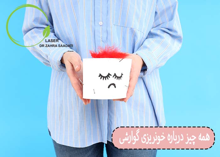خونریزی گوارشی