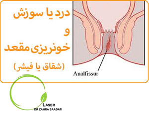 خونریزی گوارشی,علائم خونریزی گوارشی,تشخیص خونریزی گوارشی,علت خونریزی گوارشی,درمان خونریزی گوارشی,خونریزی گوارشی تحتانی,خارش مقعد, سوزش مقعد, دردناک,درمان خارش مقعد,داروی درمان خارش مقعد,علت خارش مقعد,علائم خارش مقعد