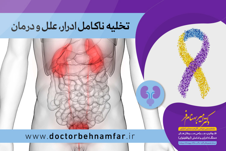 تخلیه ناکامل ادرار