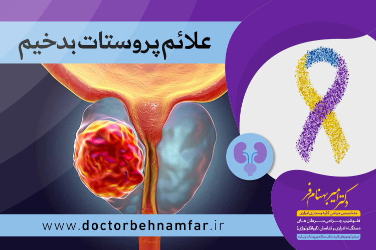 علائم پروستات بدخیم	