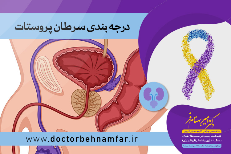 درجه بندی سرطان پروستات