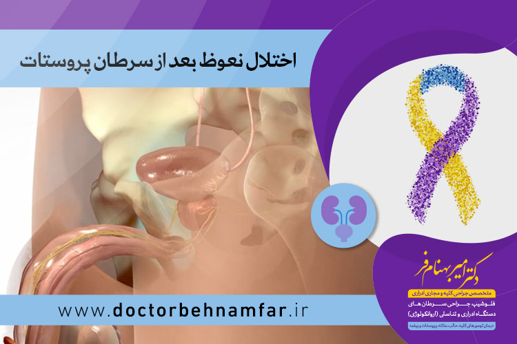 عمل پروستات