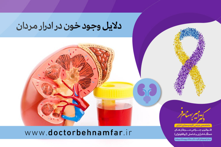 وجود خون در ادرار