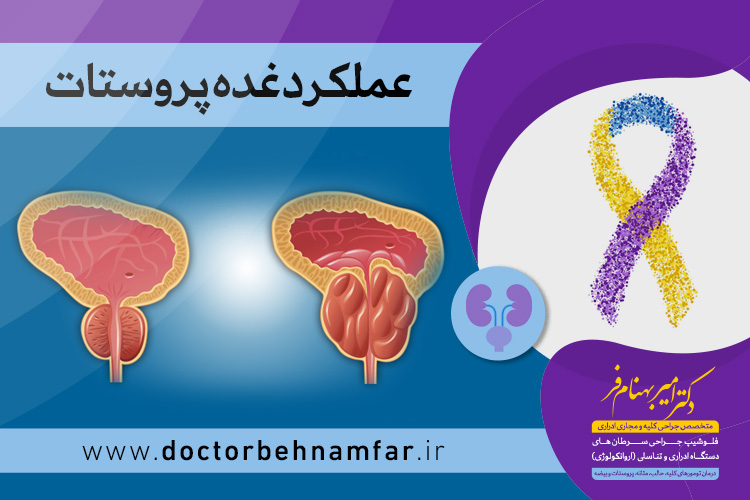 کار غده پروستات