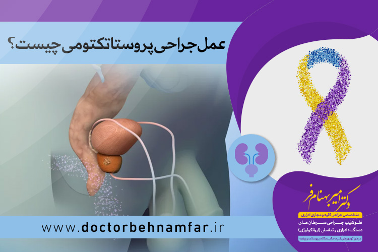 عمل جراحی پروستاتکتومی