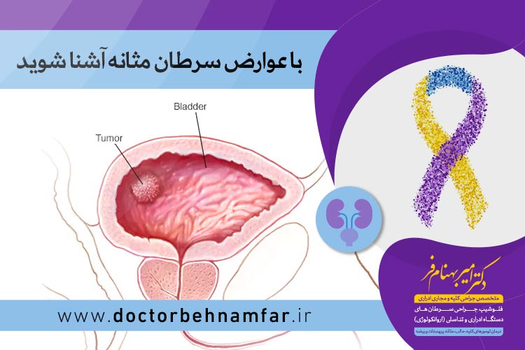 عوارض سرطان مثانه