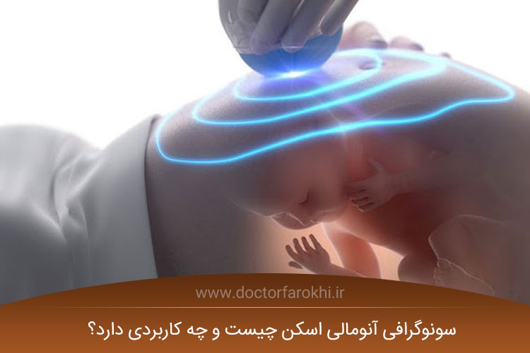 سونوگرافی آنومالی