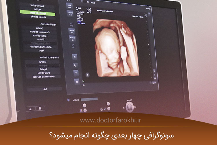 سونوگرافی چهار بعدی