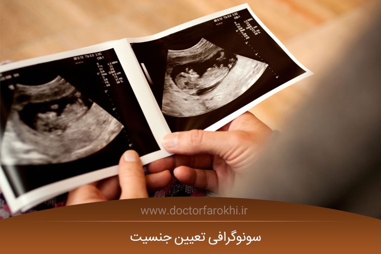 سونوگرافی تعیین جنسیت