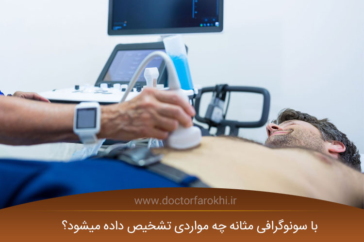 سونوگرافی مثانه