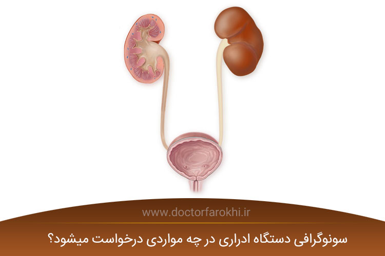 سونوگرافی دستگاه ادراری