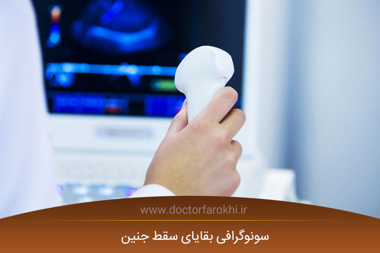 سونوگرافی بقایای سقط جنین