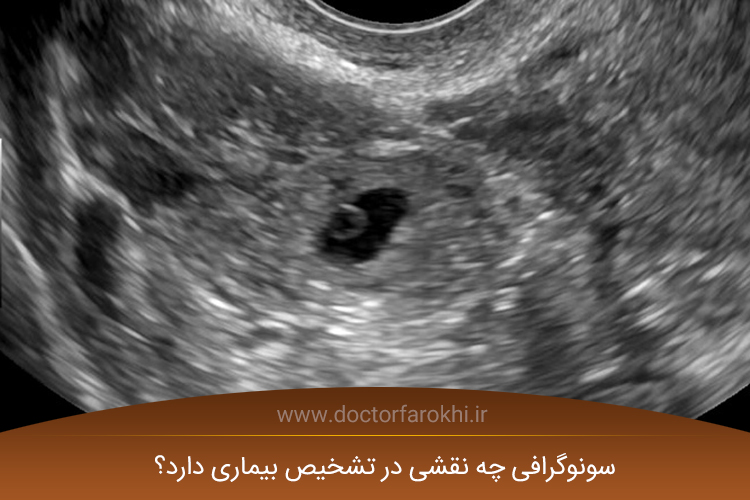 تشخیص بیماریها با سونوگرافی
