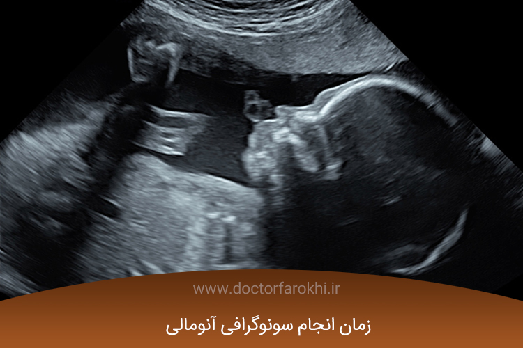 سونوگرافی آنومالی