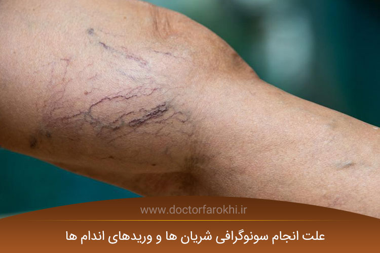 سونوگرافی شریان ها