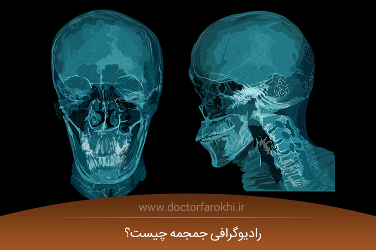 رادیوگرافی جمجمه