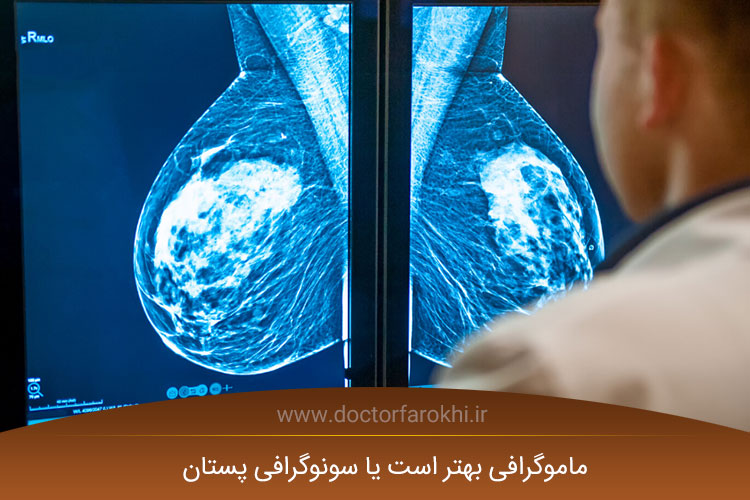 ماموگرافی بهتر است یا سونوگرافی پستان