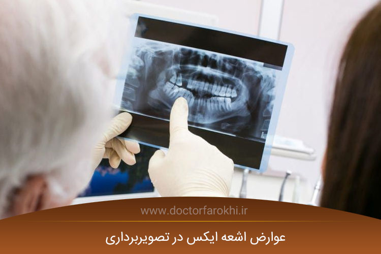 عوارض اشعه ایکس در تصویربرداری