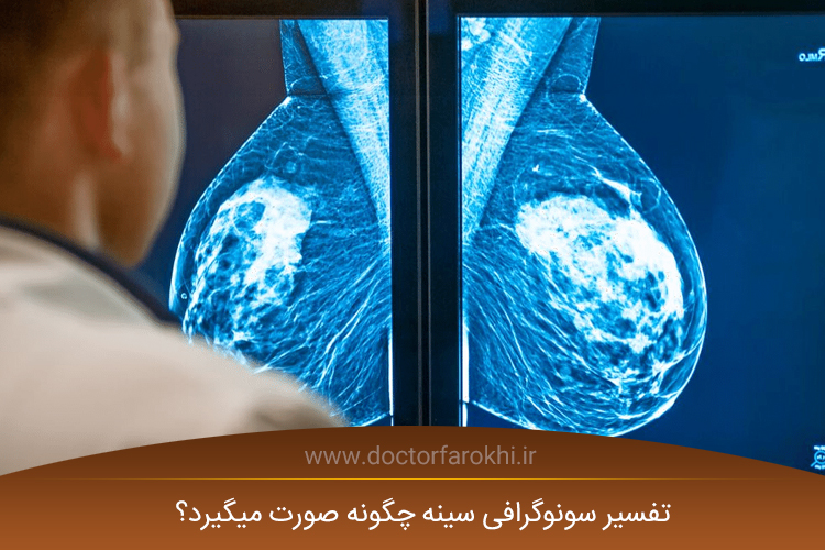 سونوگرافی پستان