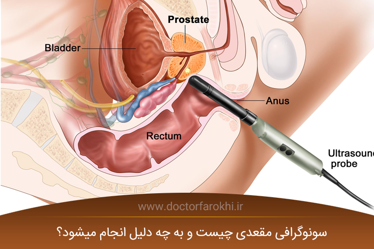 سونوگرافی مقعدی چیست