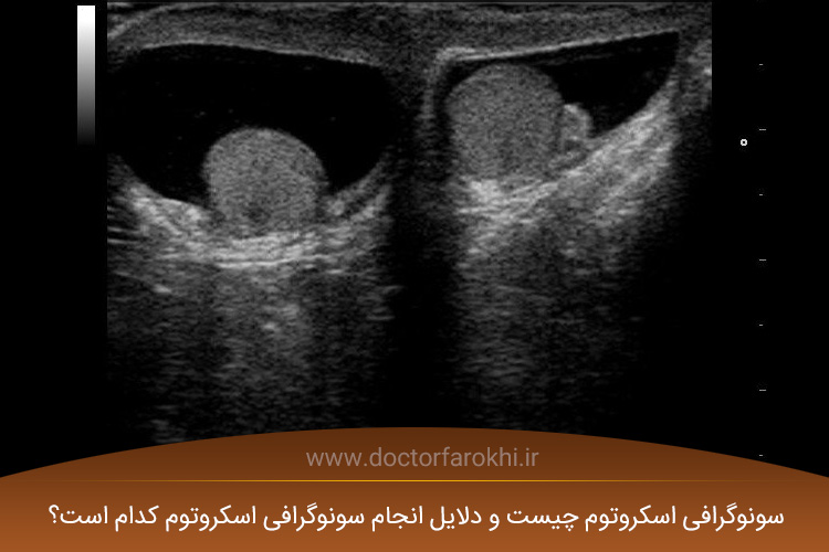 سونوگرافی اسکروتوم چیست