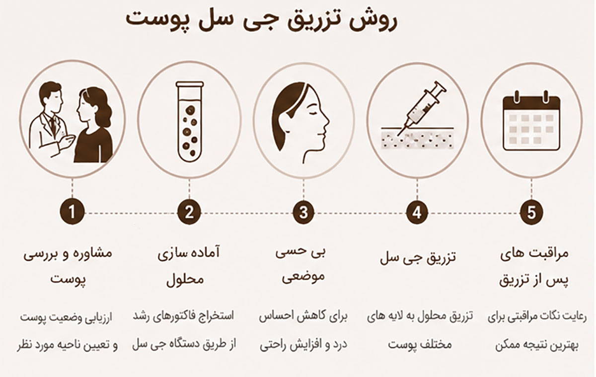 روش تزریق جی سل پوست