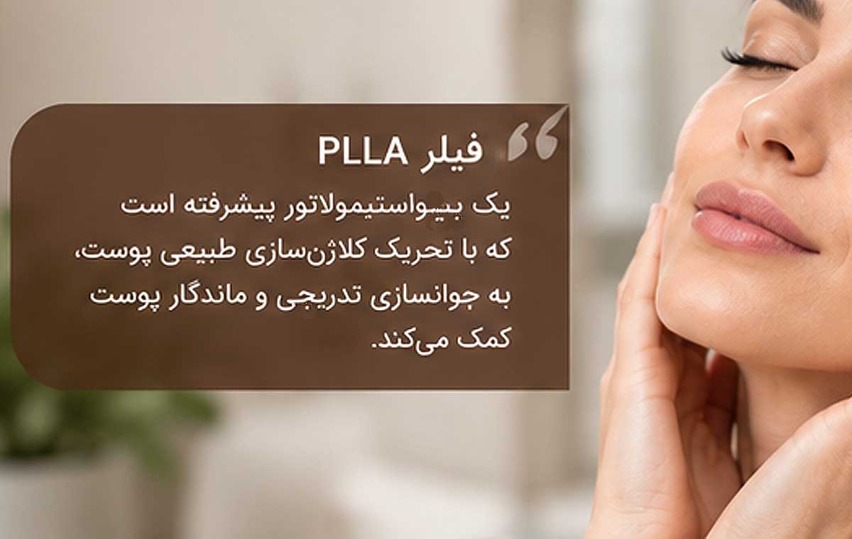 فیلر پی ال ال ای چیست