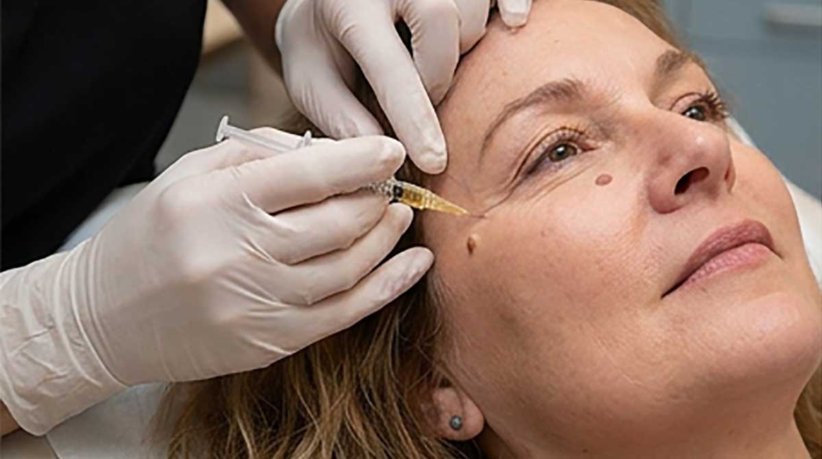 زریق پی آر اف صورت در اصفهان