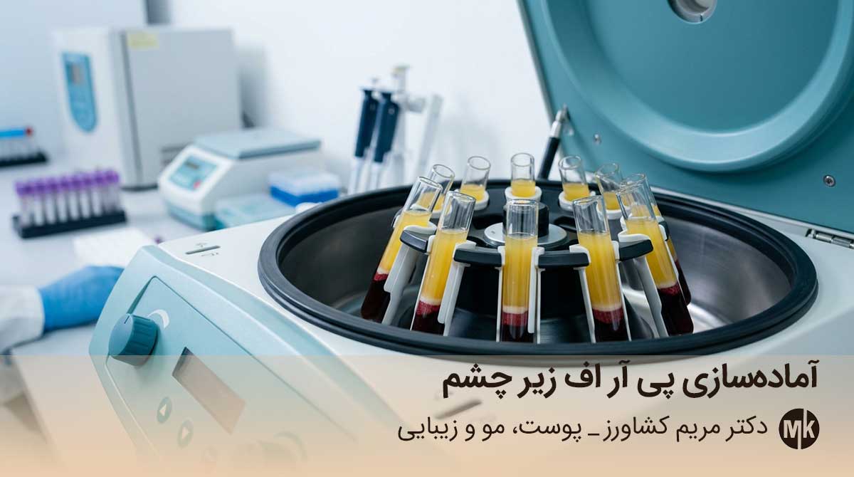 پی آر اف زیر چشم