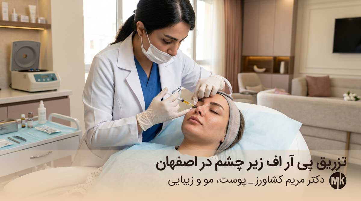 پی آر اف زیر چشم در اصفهان