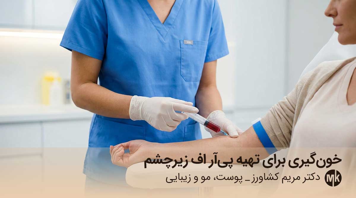 خون گیری برای تهیه پی آر اف زیر چشم