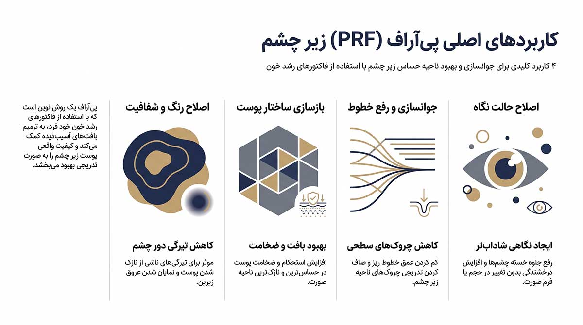 کاربردهای اصلی پی آر اف زیر چشم