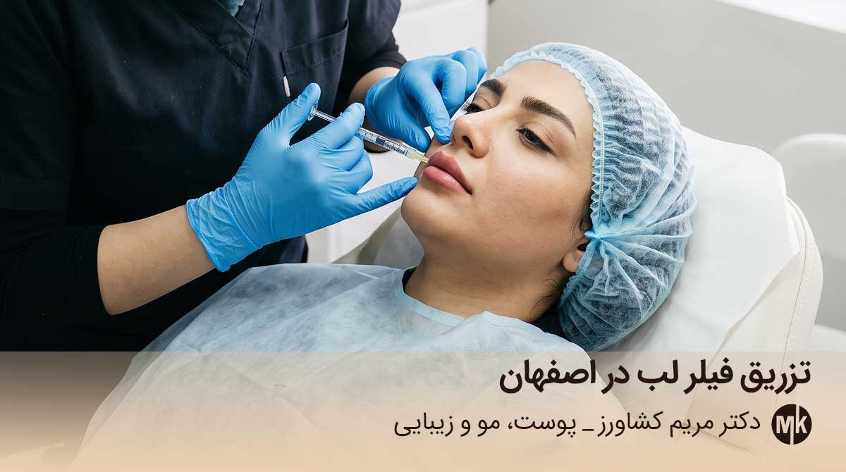 تزریق فیلر لب در اصفهان