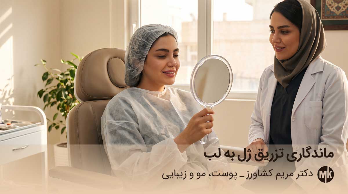 ماندگاری تزریق ژل به لب