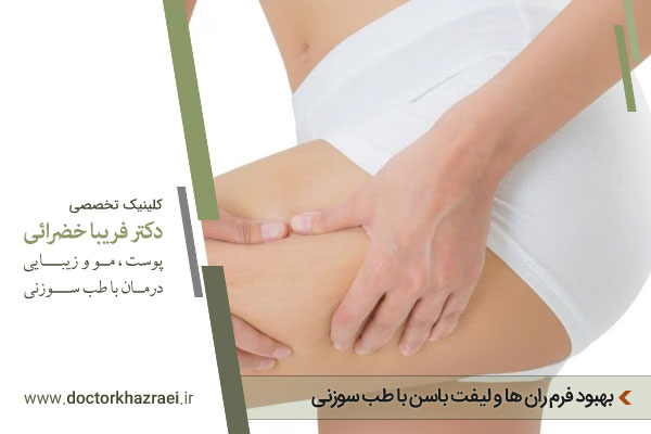 لیفت باسن با طب سوزنی