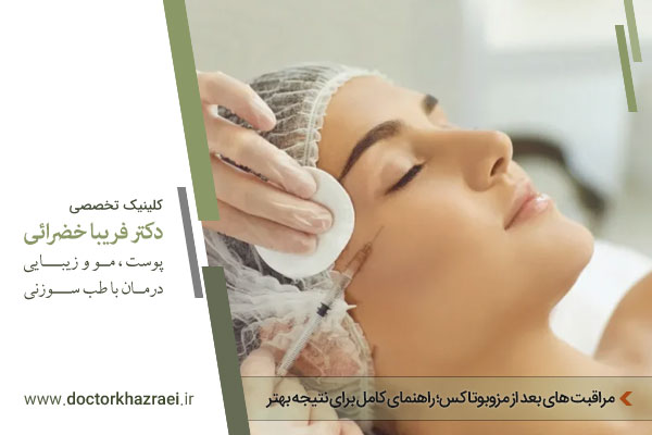 مراقبت بعد از مزوبوتاکس