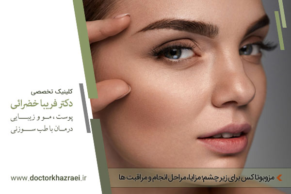 مزوبوتاکس زیر چشم چیست؟