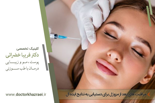 مراقبت های بعد از مزوٰل 