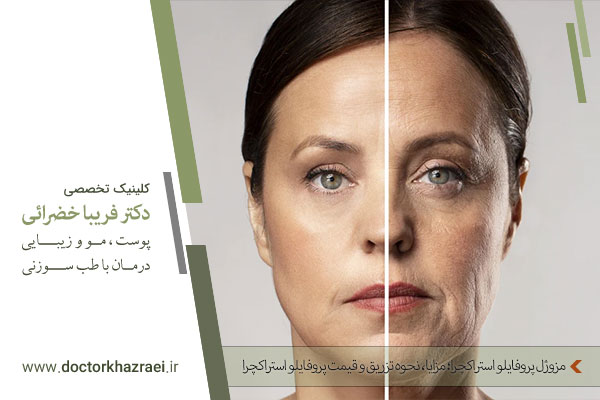 پروفایلو استراکچرا
