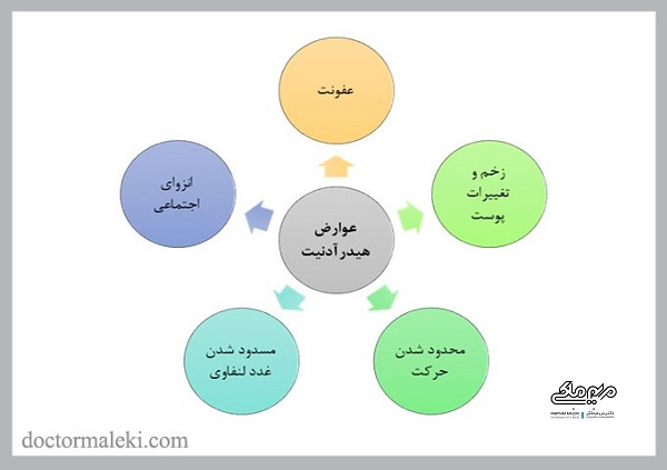 هیدرآدنیت ساپوراتيوا (چرکى) يا HS 