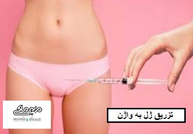 تزریق ژل به واژن