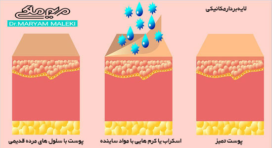 لایه بردار