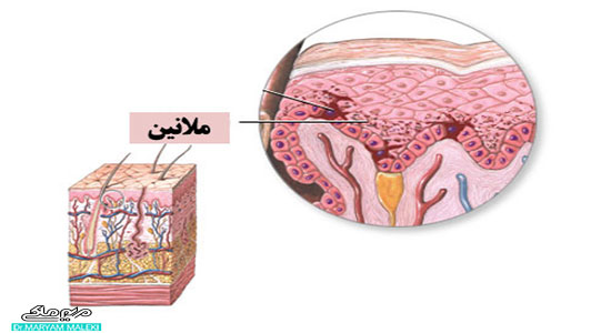 ملانین