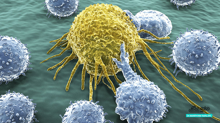 مایکوزیس فانگوئید سلول های سرطانی